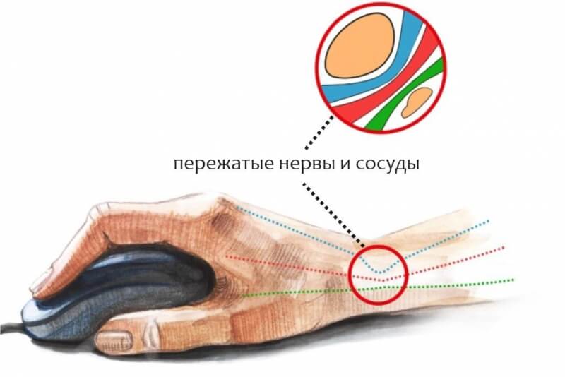 Как попасть на кракен